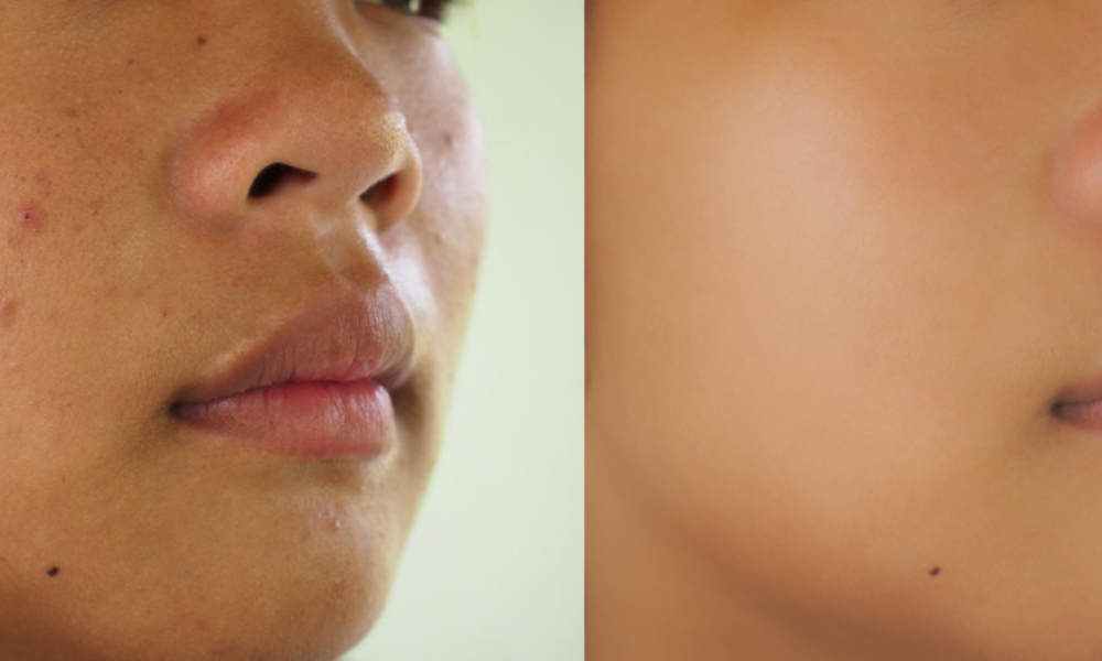 Untitled design (15)